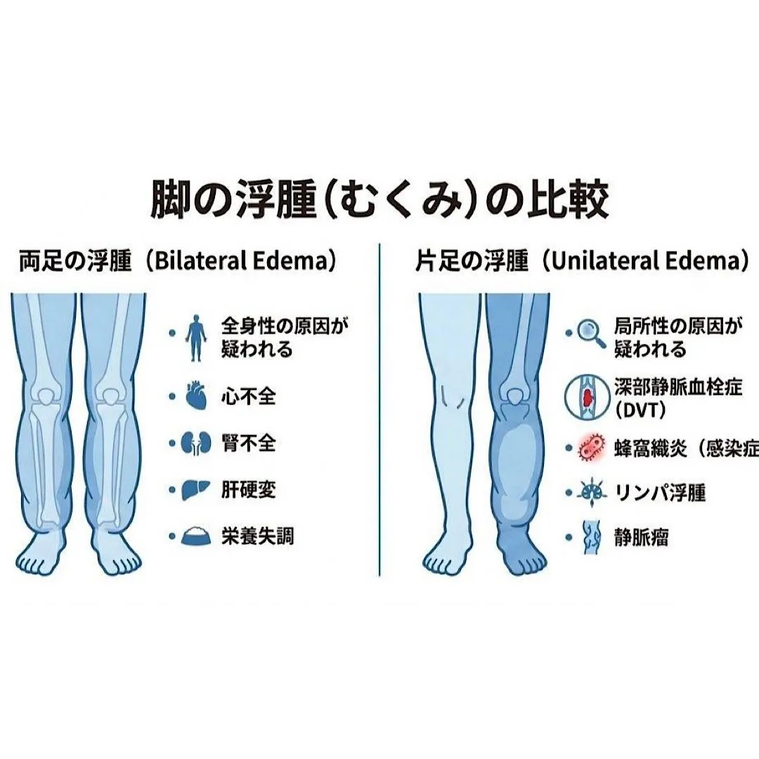 🦵「むくみ」お悩み、ありませんか?🧦